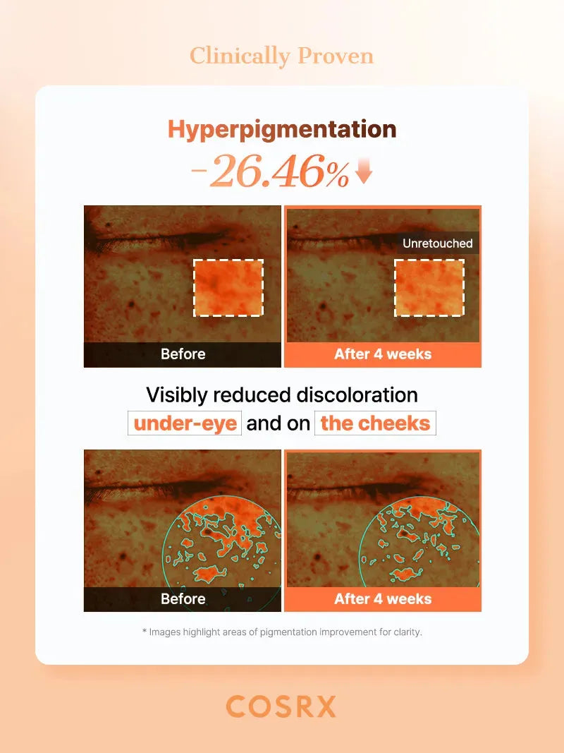 COSRX 5 PDRN Collagen Vitalizing Hydrogel Eye Patch