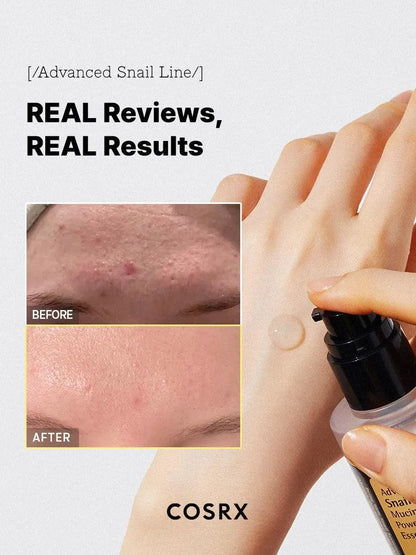 (Short-dated) Advanced Snail 96 Mucin Power Essence