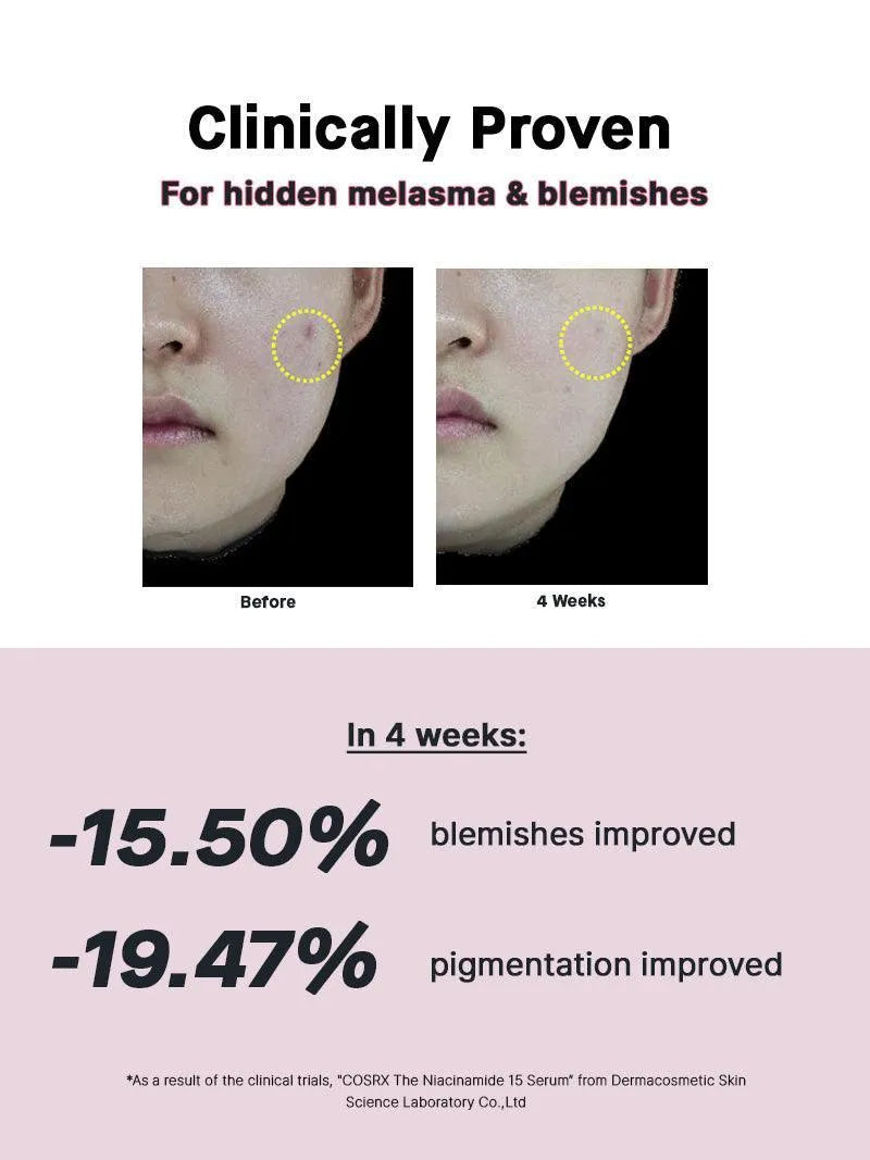 The Niacinamide 15 Serum